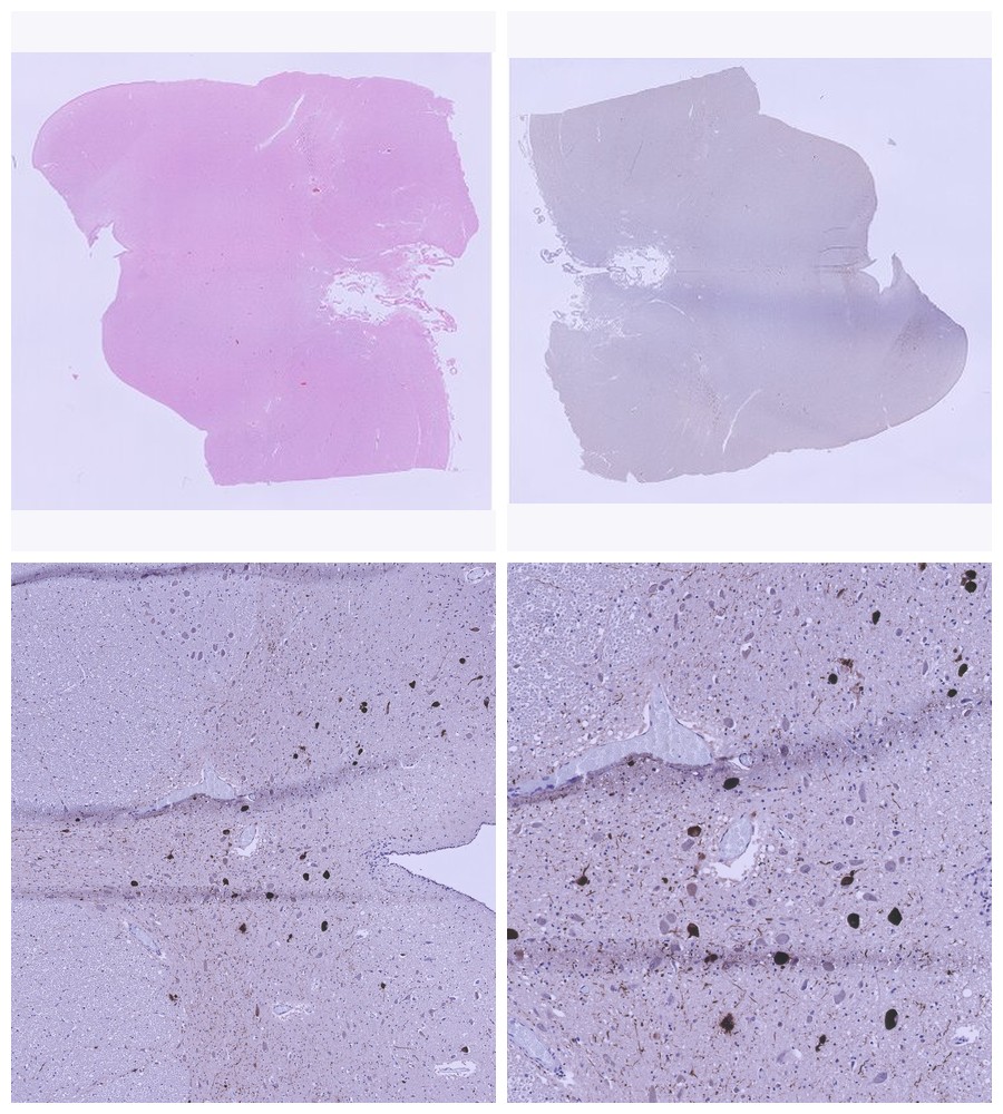 3 DIY Neurodegeneration