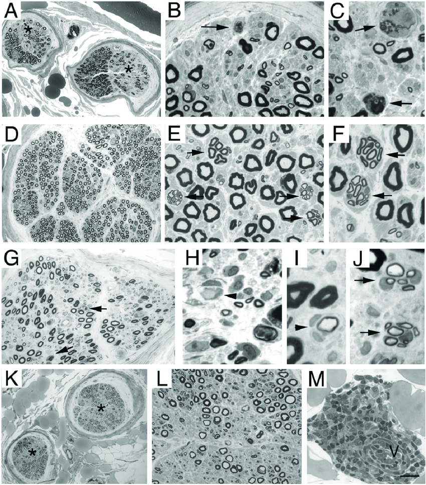 Neuropathology Monthly Case Reviews