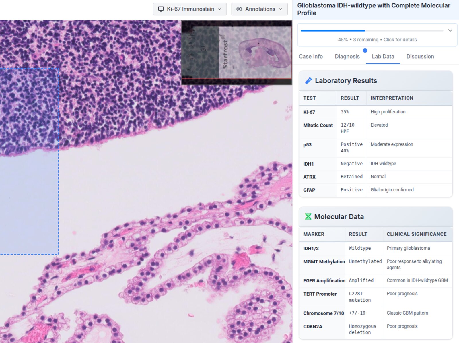 Laboratory and Molecular Data