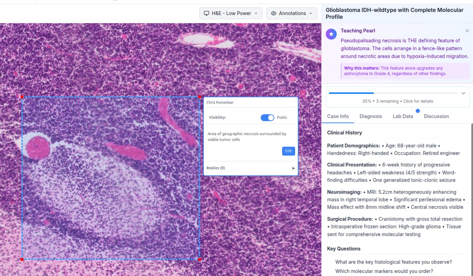Interactive Case Viewer