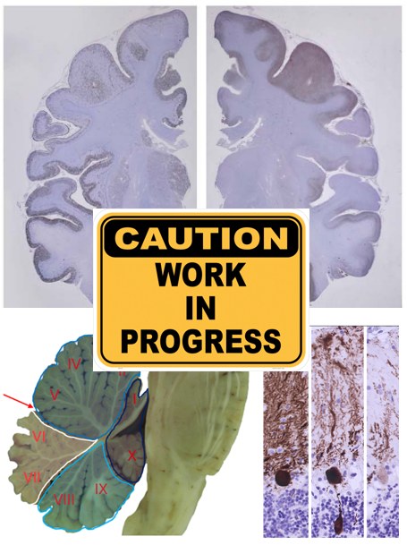 3 DIY Neurodegeneration